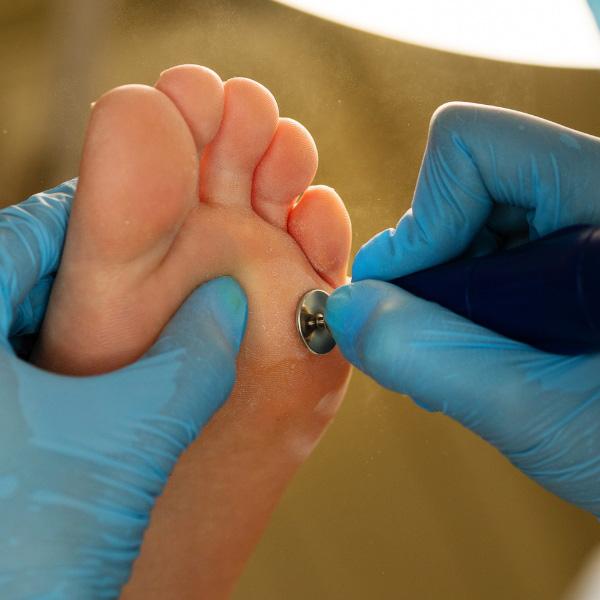 alteracions dermatològiques fàbregas
